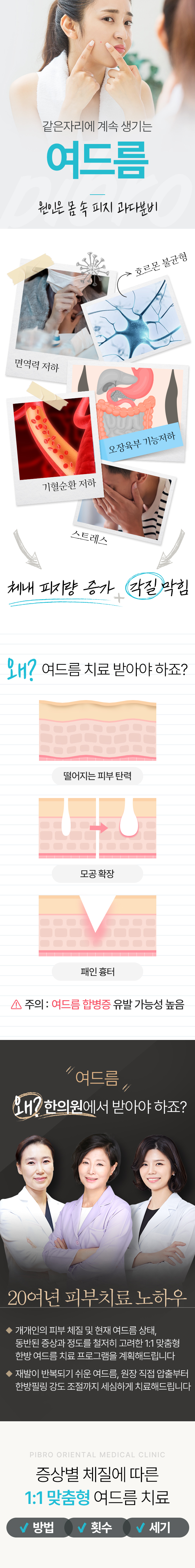 여드름 치료