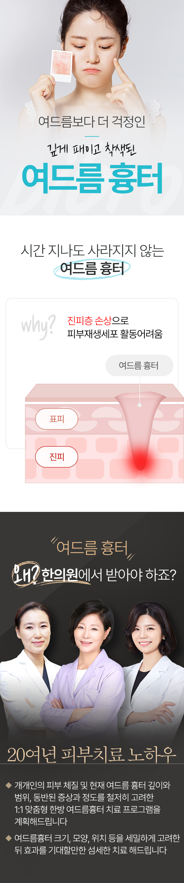 흉터,자국 치료