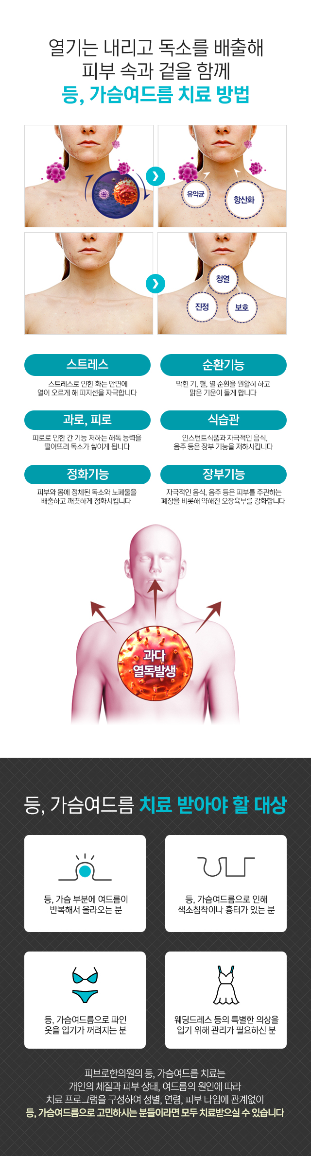 등,가슴여드름 원인