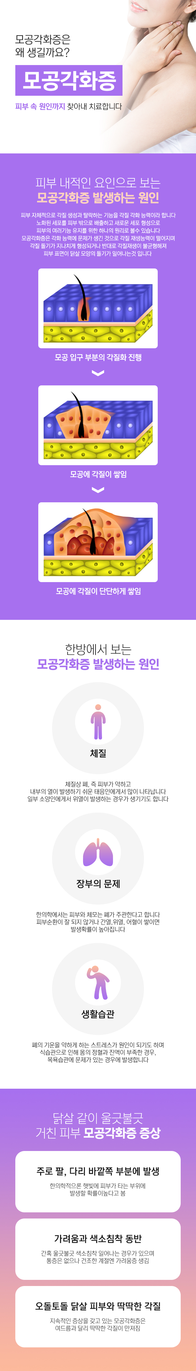 모공각화증원인